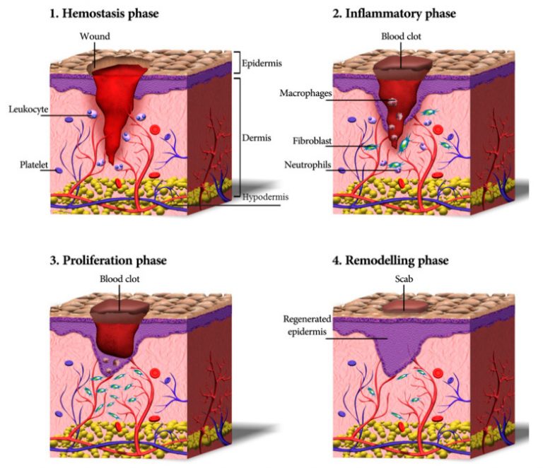 Usage of Hydrogels in Wound Healing – Hadron